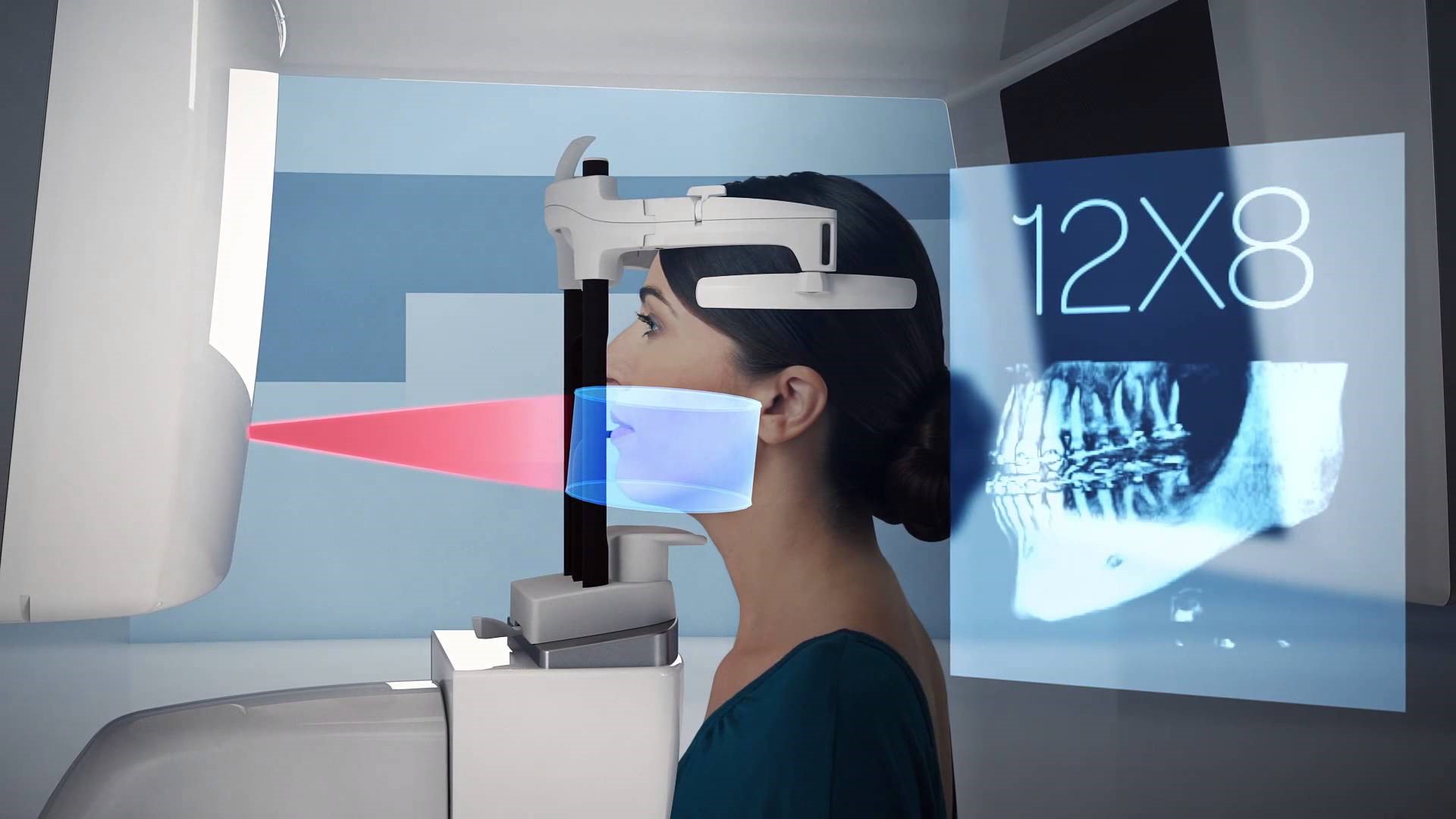 Exploring the Advancements of CBCT Technology