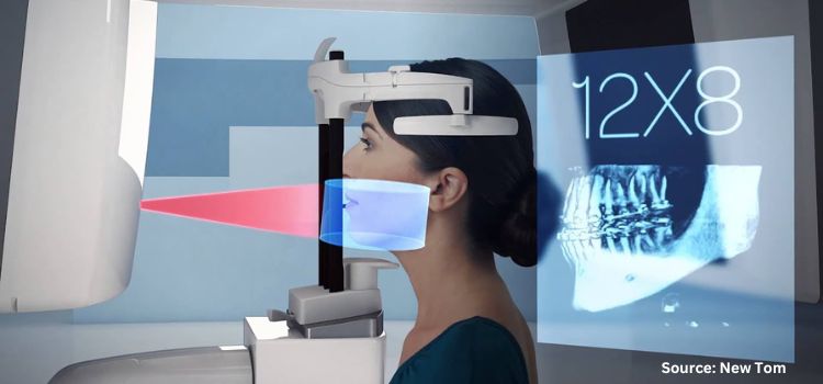 Exploring the Advancements of CBCT Technology