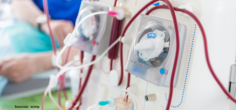 Revolutionizing Kidney Health: Latest Trends and Advancements in Dialysis Technology